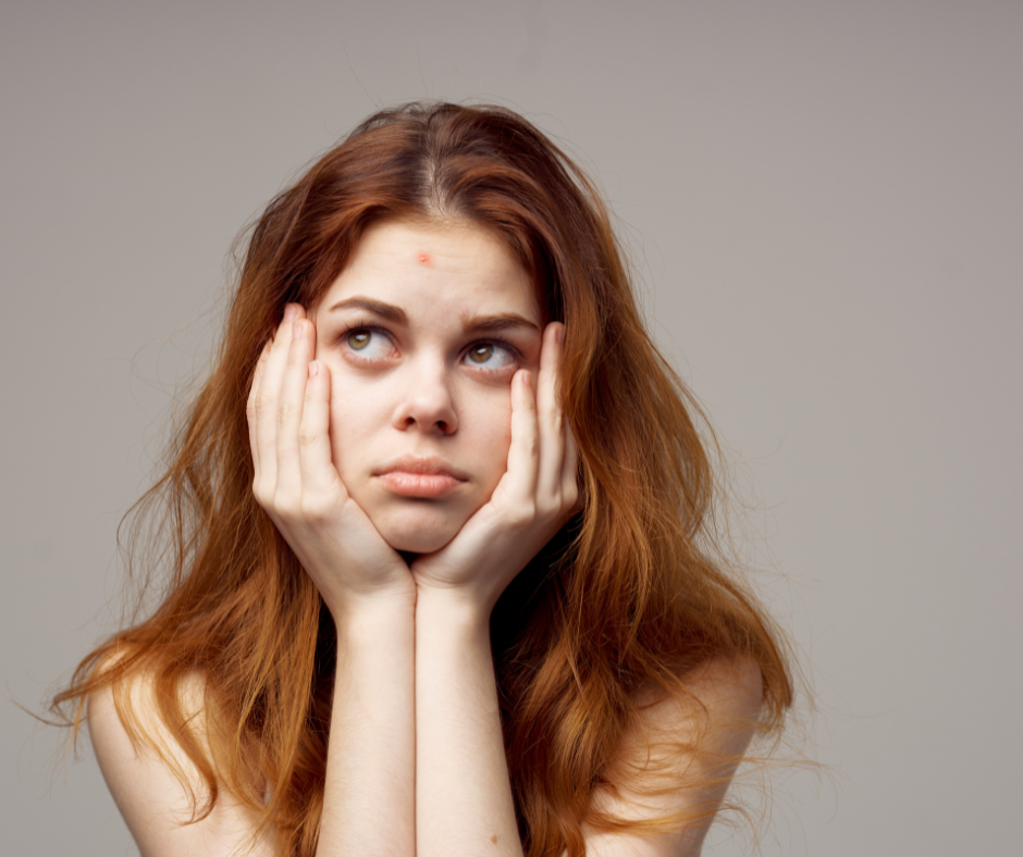 Adolescente con acné y expresión preocupada, ilustrando los cambios hormonales de la pubertad precoz y sus efectos en la salud y el envejecimiento.